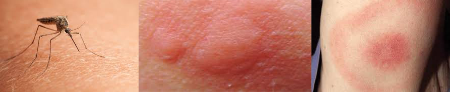 PiqMoustlabo-lab ehp boukhatmi